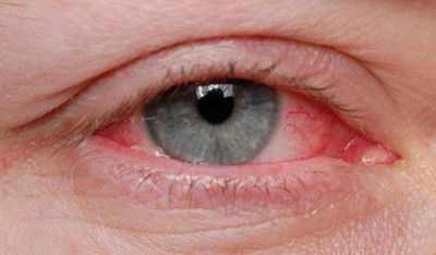 Как мозг защищен от грибковых патогенов нейтрофилами, мобилизованными с помощью CARD9