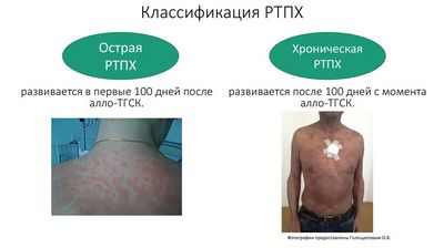 Ориентация на гистоновые деацетилазы как новая стратегия профилактики болезни трансплантат против хозяина