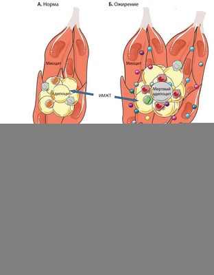 Содержание железа в макрофагах жировой ткани изменяется при ожирении